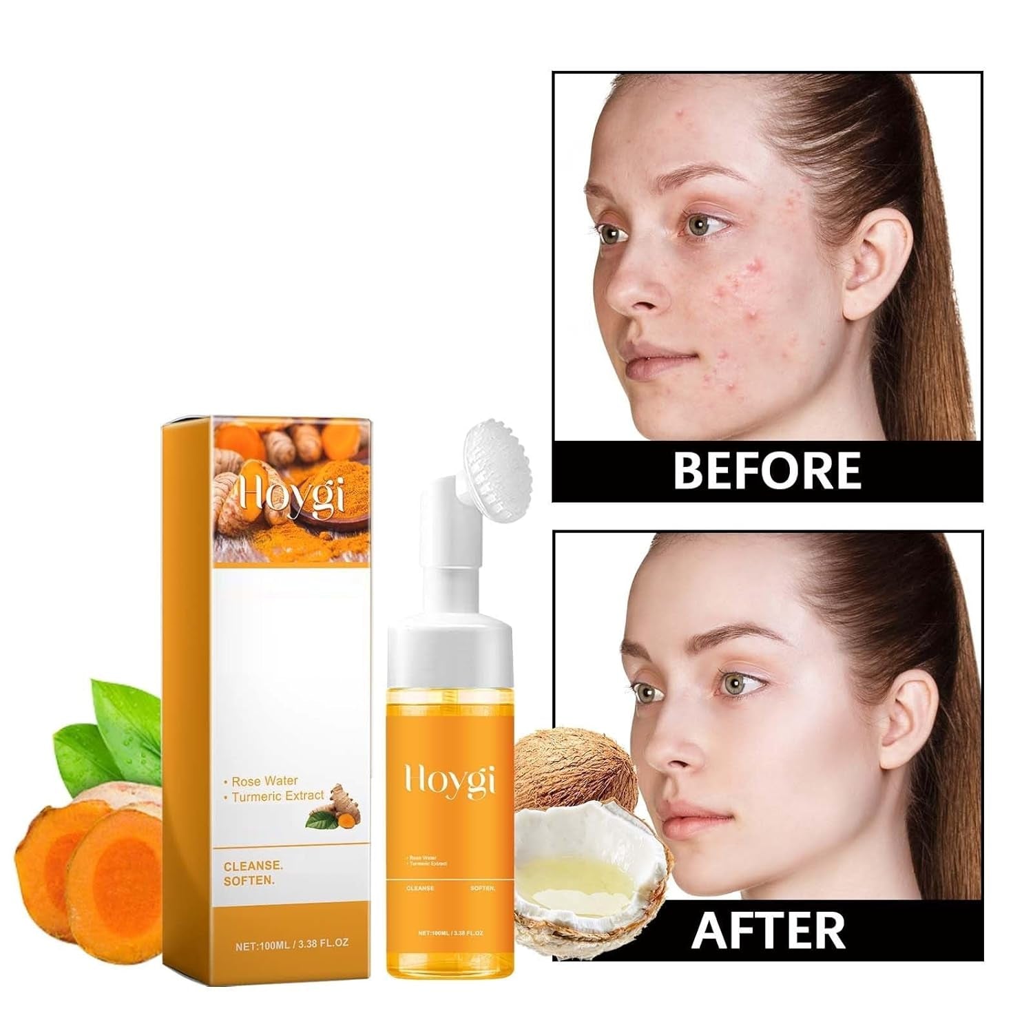 2 Pcs Hoygi Turmeric Kojic Acid Foaming Face Wash, Glow Wash Turmeric Face Wash with Brush Turmeric Foaming Facial Deep Cleansing Scrub Exfoliating.